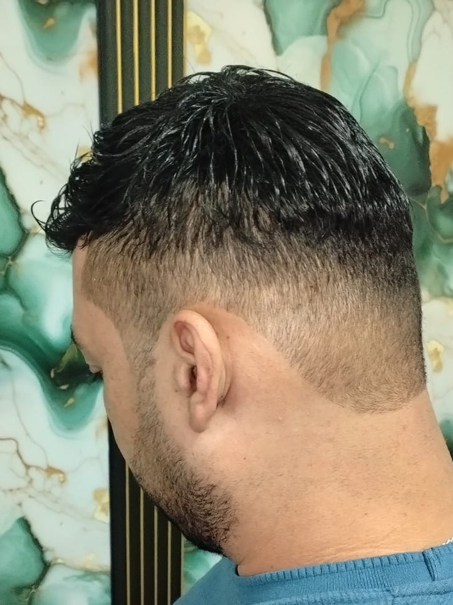 Después: prótesis de cabello negro, colocada y cortada