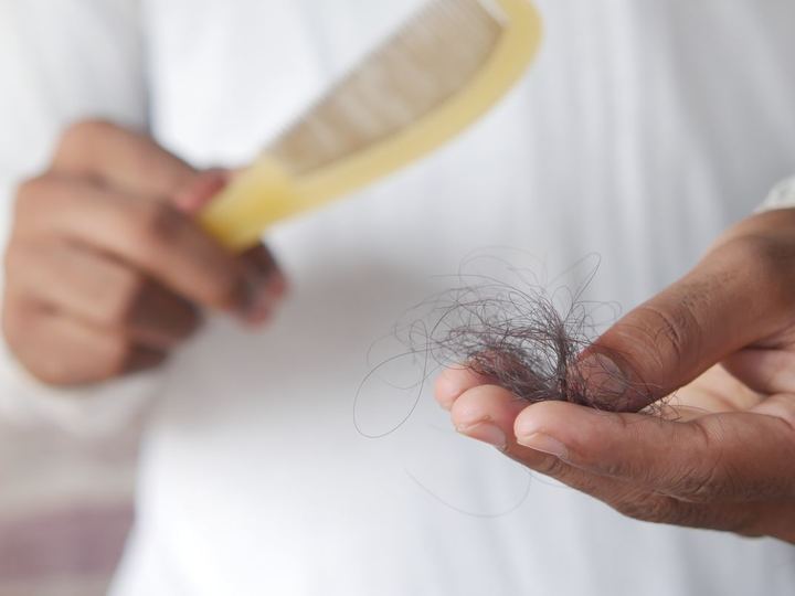 Peine con cabello caído en la mano