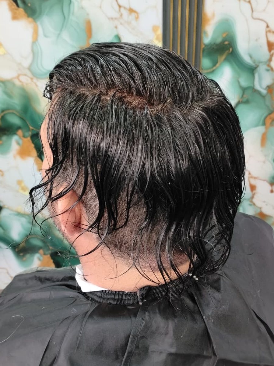 Con la prótesis de cabello negro recién colocada, antes del corte